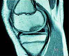 Knee Imaging